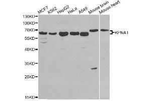 Image no. 3 for anti-Karyopherin alpha 1 (Importin alpha 5) (KPNA1) antibody (ABIN3022472)