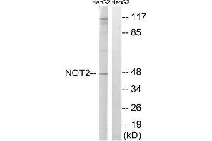 Image no. 2 for anti-CCR4-NOT Transcription Complex, Subunit 2 (CNOT2) (Ser101) antibody (ABIN1848356)