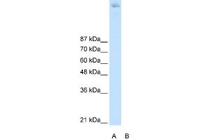 Image no. 1 for anti-Zinc Finger and BTB Domain Containing 38 (ZBTB38) (N-Term) antibody (ABIN2778613)