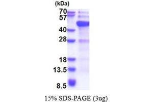 Image no. 1 for DNA (Cytosine-5-)-Methyltransferase 3 Like (TRDMT1) (AA 1-386) protein (His tag) (ABIN5853724)