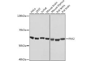 PAK2 Antikörper