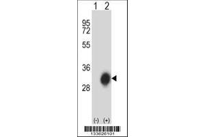 Image no. 1 for anti-Major Histocompatibility Complex, Class II, DP beta 1 (HLA-DPB1) (AA 77-105) antibody (ABIN657755)