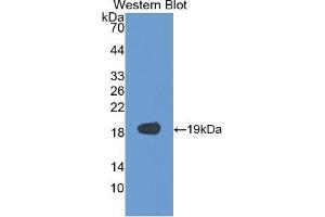 Image no. 3 for Vascular Endothelial Growth Factor A (VEGFA) ELISA Kit (ABIN6574143)