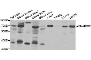Image no. 1 for anti-SWI/SNF Related, Matrix Associated, Actin Dependent Regulator of Chromatin, Subfamily D, Member 1 (SMARCD1) antibody (ABIN1980326)