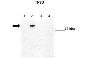 Image no. 3 for anti-Tumor Protein P73 (TP73) (N-Term) antibody (ABIN2777952)