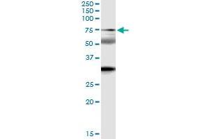 Image no. 2 for anti-Zinc Finger Protein 18 (ZNF18) (AA 1-549) antibody (ABIN948639)