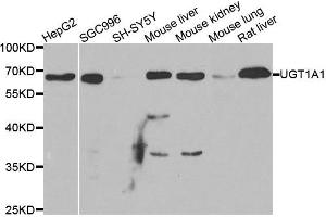 Image no. 1 for anti-UDP Glucuronosyltransferase 1 Family, Polypeptide A1 (UGT1A1) antibody (ABIN1882318)