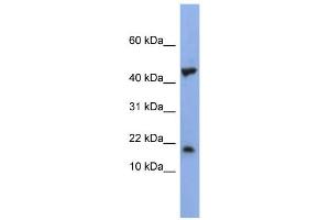 Image no. 1 for anti-LSM1 Homolog, U6 Small Nuclear RNA Associated (LSM1) (Middle Region) antibody (ABIN2779063)