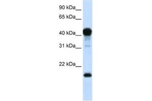 Image no. 1 for anti-TEA Domain Family Member 1 (SV40 Transcriptional Enhancer Factor) (TEAD1) antibody (ABIN2461919)
