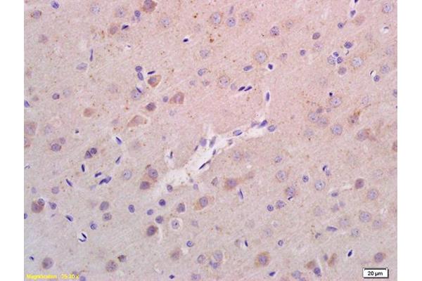 anti-Ras Homolog Enriched in Brain (RHEB) (AA 101-184) antibody