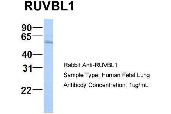 anti-RuvB-Like 1 (E. Coli) (RUVBL1) (N-Term) antibody