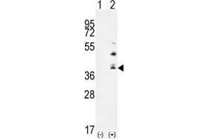 Image no. 2 for anti-Tumor Necrosis Factor (Ligand) Superfamily, Member 15 (TNFSF15) (AA 155-183), (Middle Region) antibody (ABIN955278)