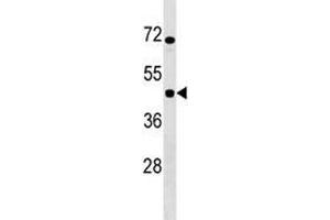 Image no. 1 for anti-Inhibitor of KB Kinase beta Interacting Protein (IKbIP) (AA 319-345) antibody (ABIN3028736)