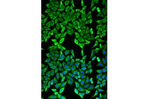 Image no. 2 for anti-Myelin Oligodendrocyte Glycoprotein (MOG) antibody (ABIN6569861)