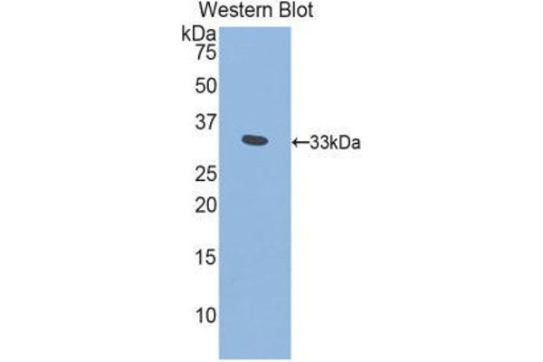 anti-Pitrilysin Metallopeptidase 1 (PITRM1) (AA 653-926) antibody