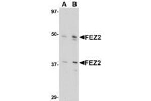Image no. 1 for anti-Fasciculation and Elongation Protein zeta 2 (Zygin II) (FEZ2) (Internal Region) antibody (ABIN1493789)