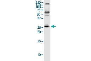 Image no. 1 for anti-Interleukin 23, alpha subunit p19 (IL23A) (AA 1-189) antibody (ABIN2565633)