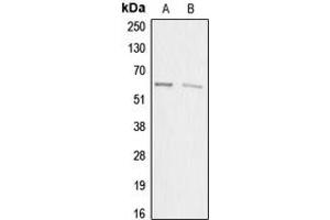Image no. 2 for anti-Acrosin Binding Protein (ACRBP) (Center) antibody (ABIN2705394)