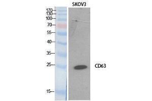 Image no. 1 for anti-CD63 (CD63) (Internal Region) antibody (ABIN3181065)