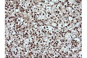 Image no. 3 for anti-Mitogen-Activated Protein Kinase 4 (MAPK4) antibody (ABIN1499312)