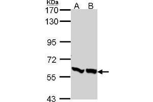 Image no. 3 for anti-6-phosphofructo-2-Kinase/fructose-2,6-Biphosphatase 3 (PFKFB3) (C-Term) antibody (ABIN2856593)