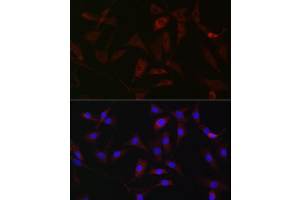 Hexokinase 1 anticorps  (AA 20-300)