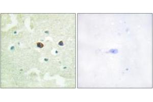 Immunohistochemistry analysis of paraffin-embedded human brain, using PTP1B (Phospho-Ser50) Antibody.