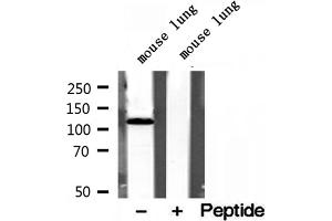 Image no. 1 for anti-alpha Ketoglutarate Dehydrogenase (alphaKGDHC) (N-Term) antibody (ABIN6263803)