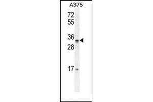 Image no. 1 for anti-Pseudouridylate Synthase-Like 1 (PUSL1) (AA 213-243), (C-Term) antibody (ABIN954390)