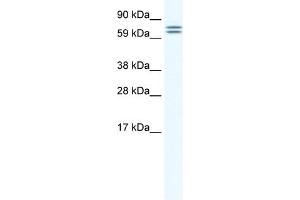 anti-Carboxylesterase 4A (CES4A) (Middle Region) antibody