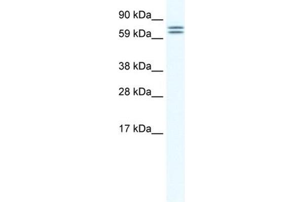 anti-Carboxylesterase 4A (CES4A) (Middle Region) antibody
