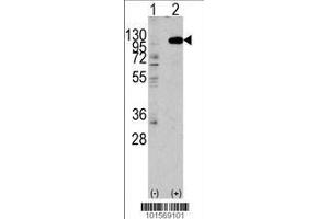 Image no. 1 for anti-Fibroblast Growth Factor Receptor 2 (FGFR2) (AA 794-821), (C-Term) antibody (ABIN391966)