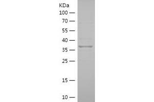 PIGZ Protein (AA 431-579) (His-IF2DI Tag)