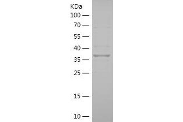 PIGZ Protein (AA 431-579) (His-IF2DI Tag)