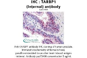 Image no. 1 for anti-TAR (HIV-1) RNA Binding Protein 1 (TARBP1) (Internal Region) antibody (ABIN1739905)