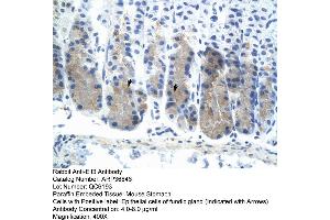 Image no. 1 for anti-E74-Like Factor 3 (Ets Domain Transcription Factor, Epithelial-Specific) (ELF3) (N-Term) antibody (ABIN2779832)