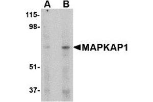Image no. 1 for anti-Mitogen-Activated Protein Kinase Associated Protein 1 (MAPKAP1) (Middle Region) antibody (ABIN1030995)