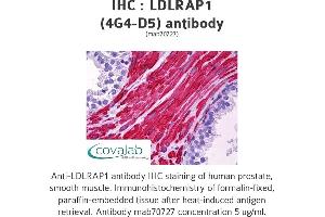 Image no. 1 for anti-Low Density Lipoprotein Receptor Adaptor Protein 1 (LDLRAP1) (AA 1-264), (full length) antibody (ABIN1723584)