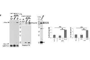 Image no. 91 for anti-Glyceraldehyde-3-Phosphate Dehydrogenase (GAPDH) (Center) antibody (ABIN2857072)