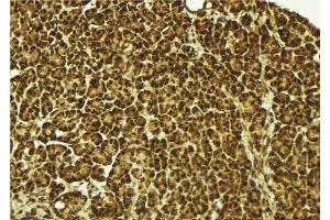 Image no. 2 for anti-Heterogeneous Nuclear Ribonucleoprotein D-Like (HNRPDL) (C-Term) antibody (ABIN6262334)