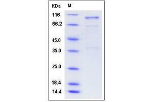 Image no. 1 for Sema Domain, Immunoglobulin Domain (Ig), Short Basic Domain, Secreted, (Semaphorin) 3A (SEMA3A) (AA 26-546), (N-Term) protein (Fc Tag) (ABIN2008081)