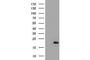 Image no. 1 for anti-ADP-Ribosylation Factor-Like 2 Binding Protein (ARL2BP) antibody (ABIN1496718)