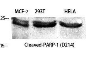 Image no. 3 for anti-Poly (ADP-Ribose) Polymerase 1 (PARP1) (Asp214), (cleaved) antibody (ABIN3181849)