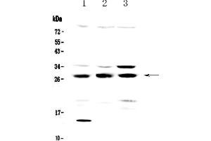 Western blot analysis of TPMT using anti-TPMT antibody .
