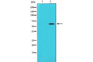 Image no. 2 for anti-Cytochrome P450, Family 11, Subfamily A, Polypeptide 1 (CYP11A1) (C-Term) antibody (ABIN6261164)