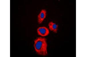 Image no. 2 for anti-Absent in Melanoma 2 (AIM2) (Center) antibody (ABIN2705417)