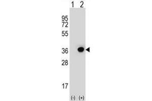 Image no. 2 for anti-Dehydrogenase/reductase (SDR Family) Member 3 (DHRS3) (AA 92-121), (Middle Region) antibody (ABIN951904)