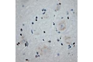 Image no. 5 for anti-SH3 and Multiple Ankyrin Repeat Domains 3 (SHANK3) (Internal Region) antibody (ABIN350831)