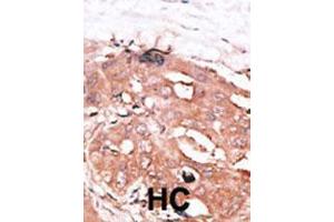 Image no. 1 for anti-Autophagy related 4D Cysteine Peptidase (ATG4D) (AA 14-43), (N-Term) antibody (ABIN1882161)
