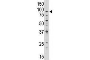 Image no. 1 for anti-ATP-Binding Cassette, Sub-Family B (MDR/TAP), Member 7 (ABCB7) (AA 718-746) antibody (ABIN3030053)